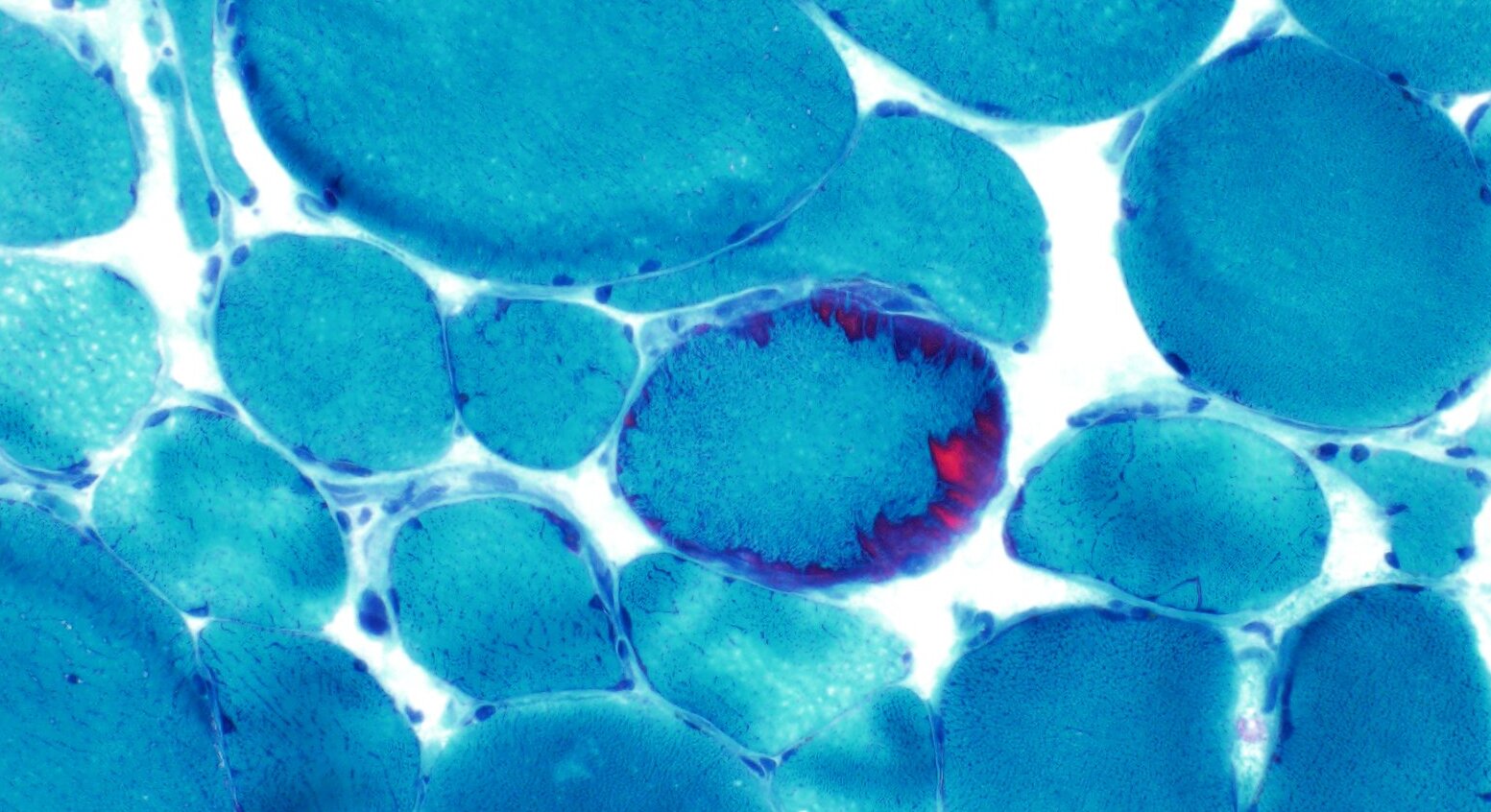 Arkana Laboratories plans 30 million expansion, adding jobs in Little